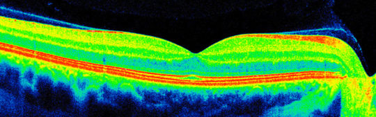 A Look Into Our Eye Care Technology